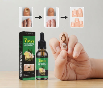 7 DAYS Tratamiento para Hongos uñas manos y pies.